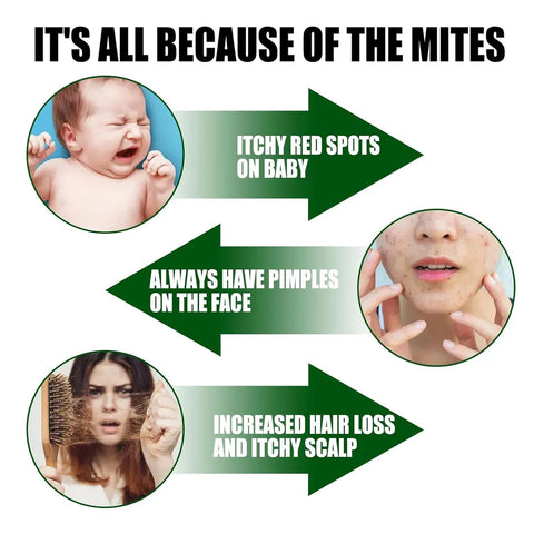 South Moon - Green Prickly Ash Herbal Mite Remover (Original)